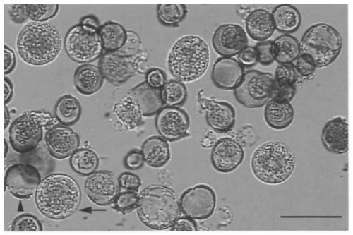 Protoplast isolation and genetic transformation method of Brassica napus without restriction of genotype and regeneration system thereof