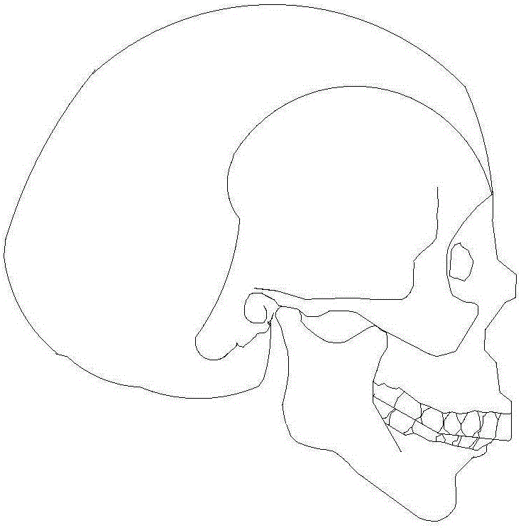 Multiloop edgewise arch wire for jaw malformation correction and jaw malformation correction method