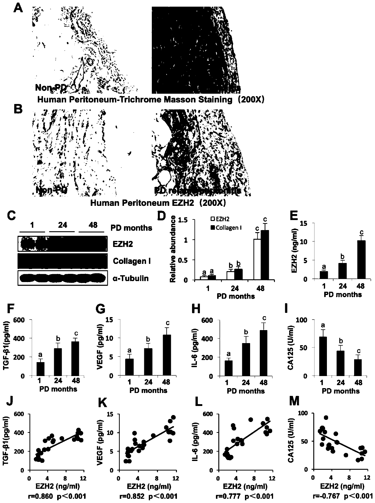 Application of inhibitor of histone methyltransferase EZH2 to preparing medicine for controlling peritoneum fibrosis after peritoneal dialysis