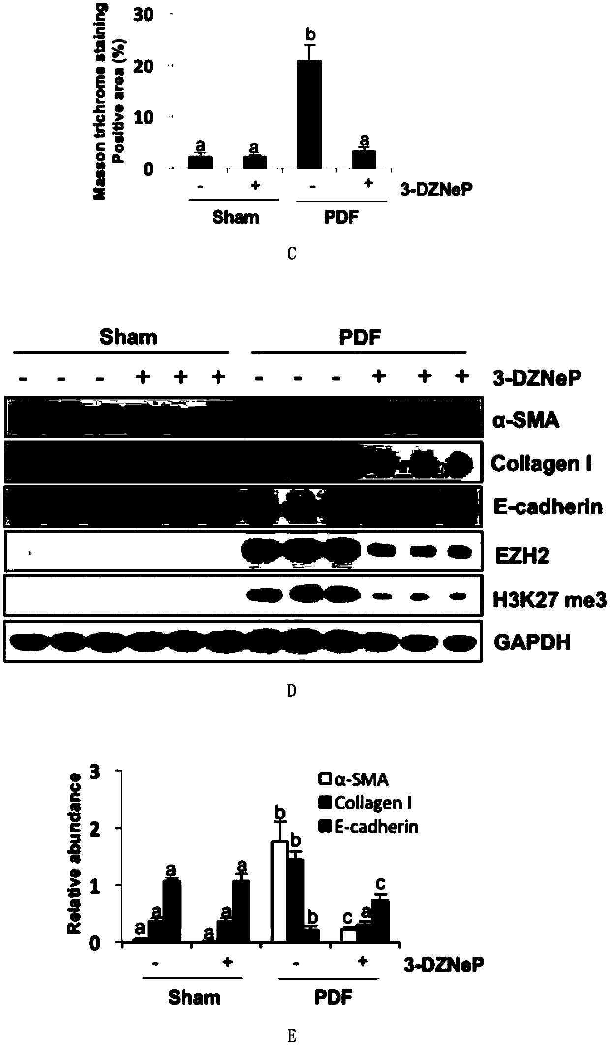 Application of inhibitor of histone methyltransferase EZH2 to preparing medicine for controlling peritoneum fibrosis after peritoneal dialysis