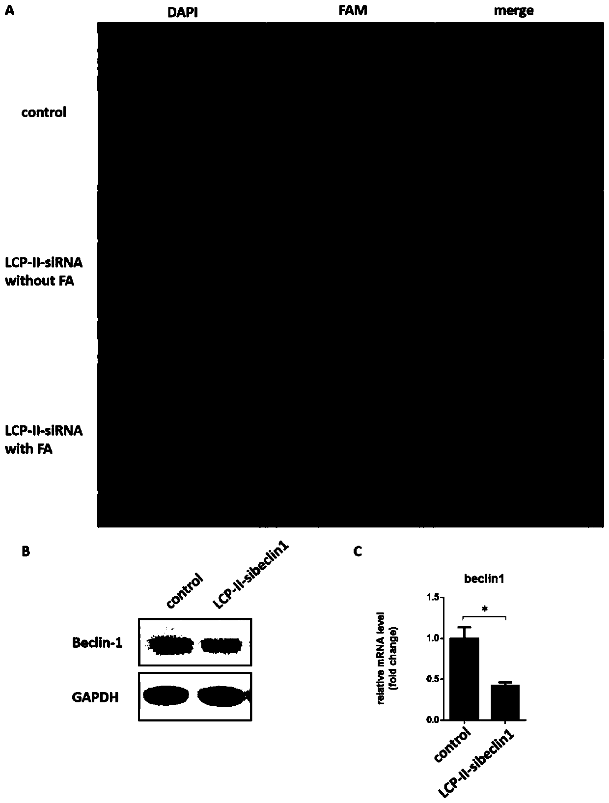 Co-delivery of lipid nanoparticles with autophagy siRNA-fingolimod targeting liver cancer