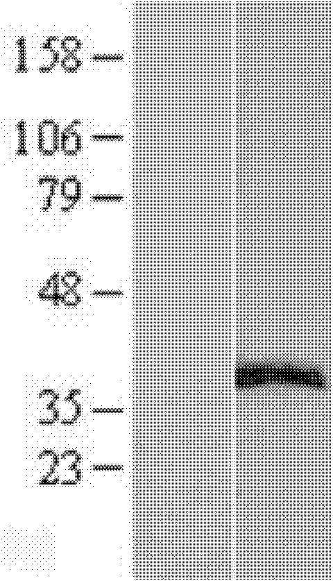 Anti ERCC1 monoclonal antibody 2E12 and application