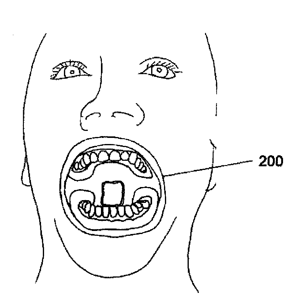 Methods, devices, systems, assemblies, and kits for tissue retraction in an oral cavity