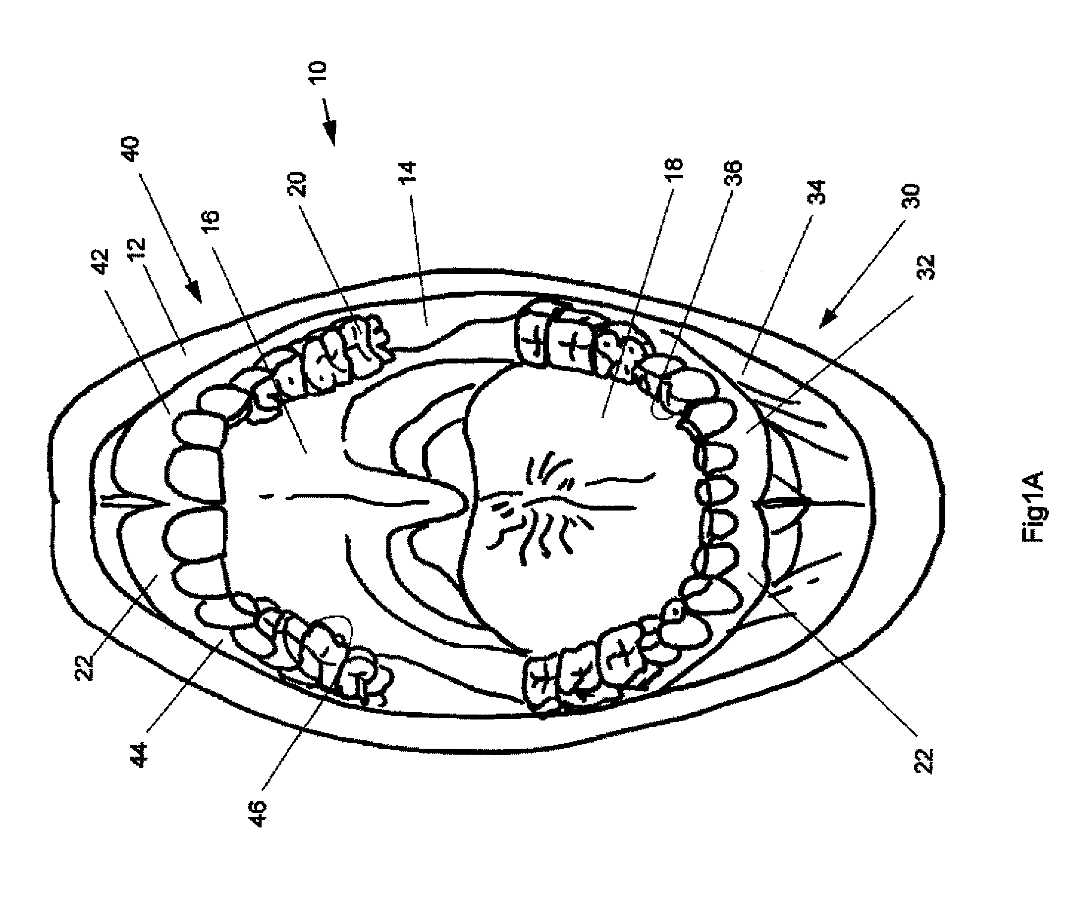 Methods, devices, systems, assemblies, and kits for tissue retraction in an oral cavity