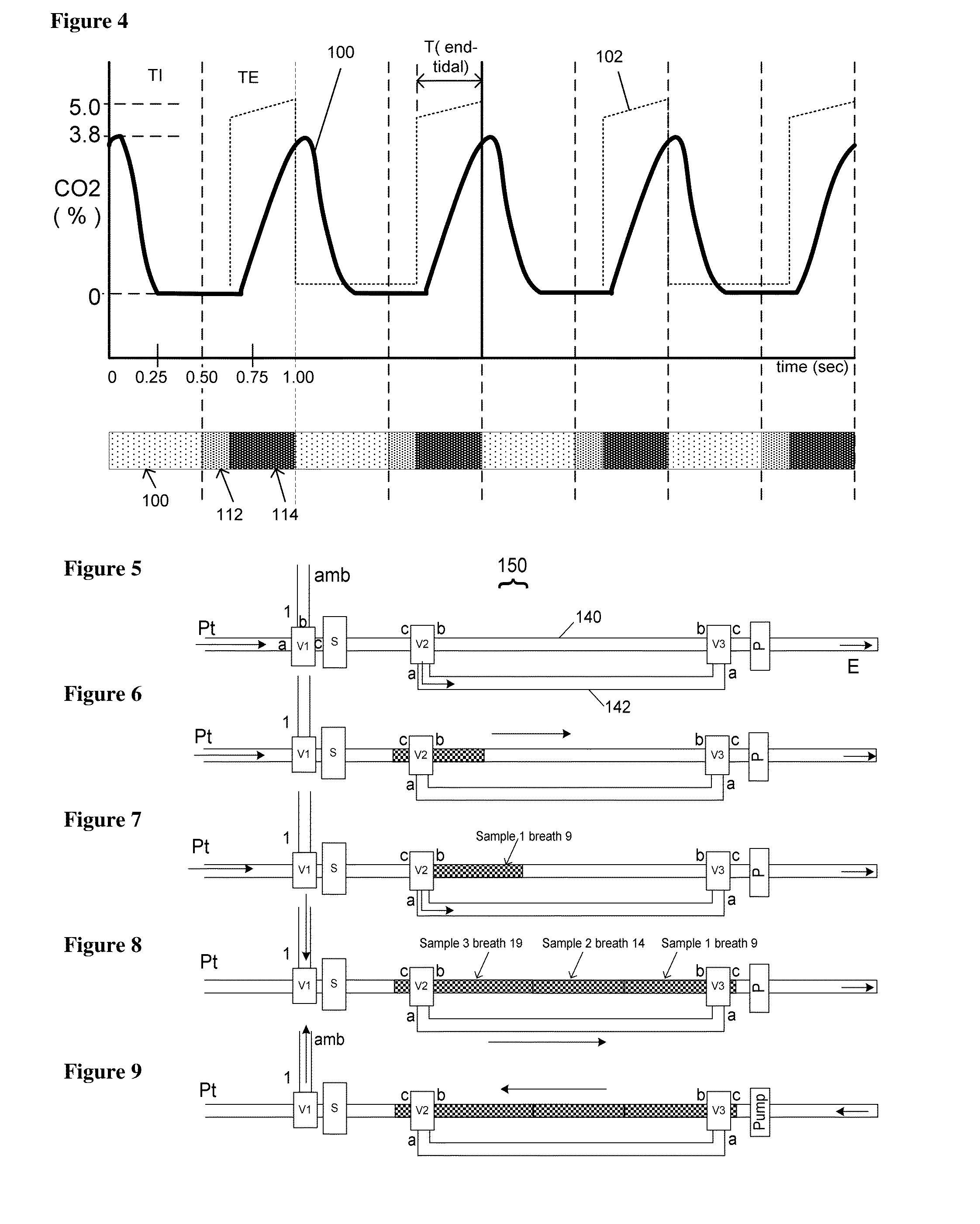 Neonatal carbon dioxide measurement system