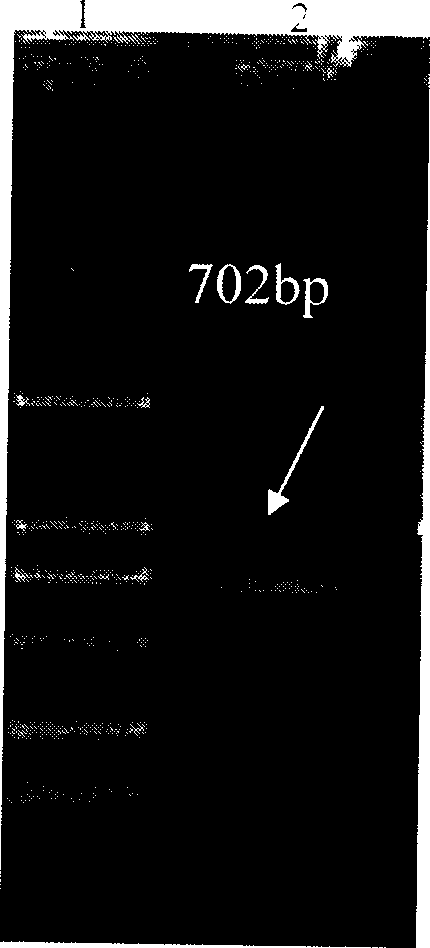 Method for expressing anthrax bacteria gamma phage lyase and its special gene