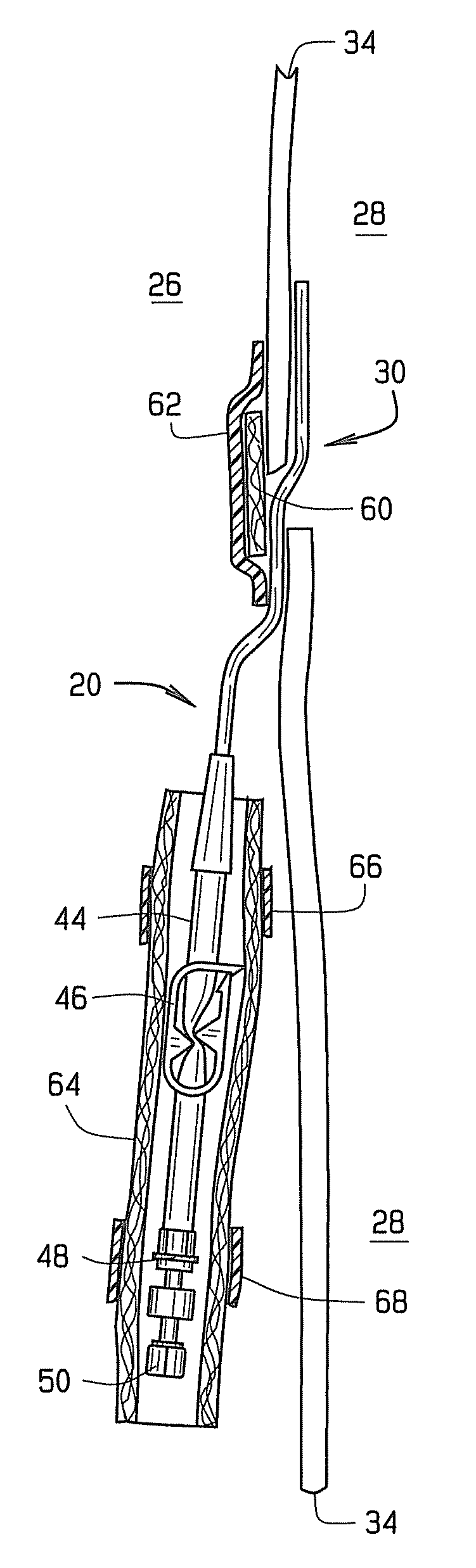 Disposable shower guard for renal access catheter