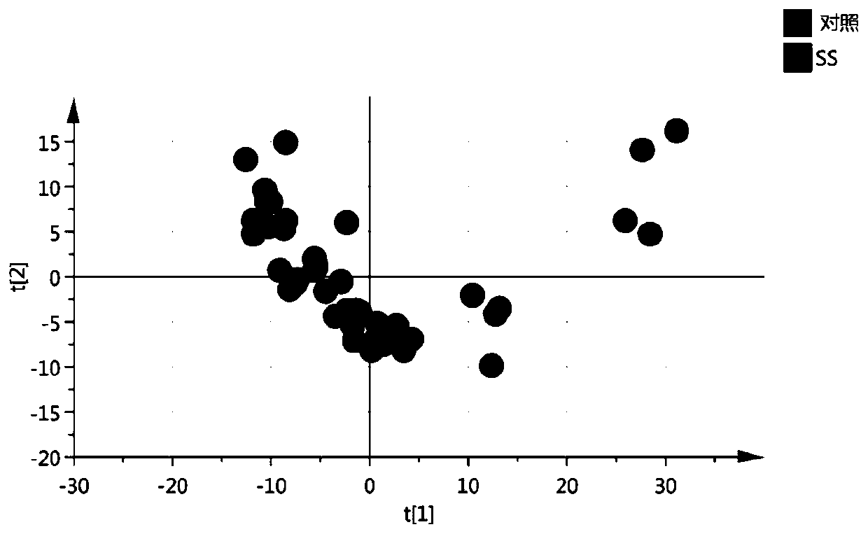 Protein markers for Sjögren's syndrome in saliva and uses thereof