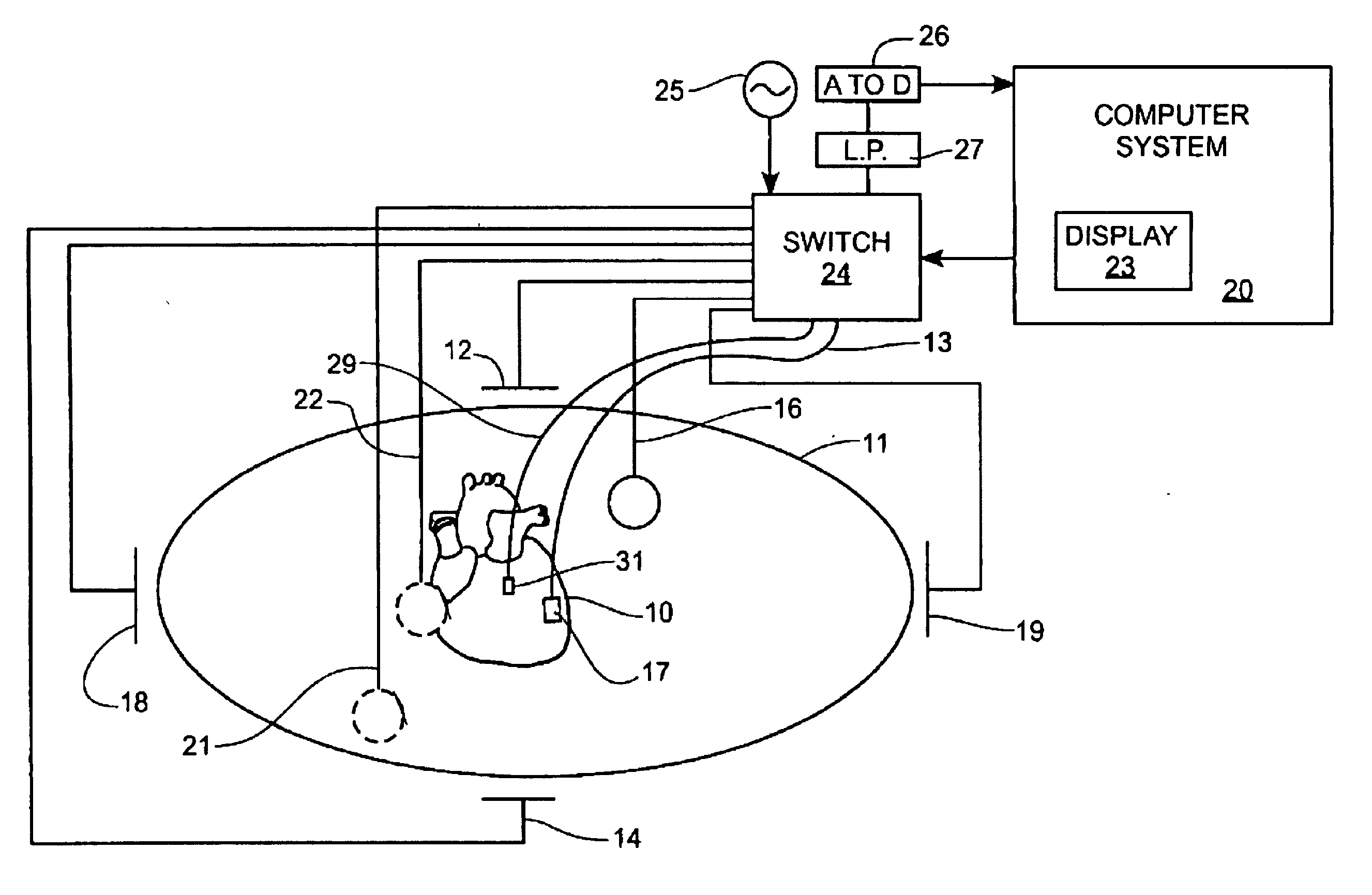 Method of scaling navigation signals to account for impedance drift in tissue