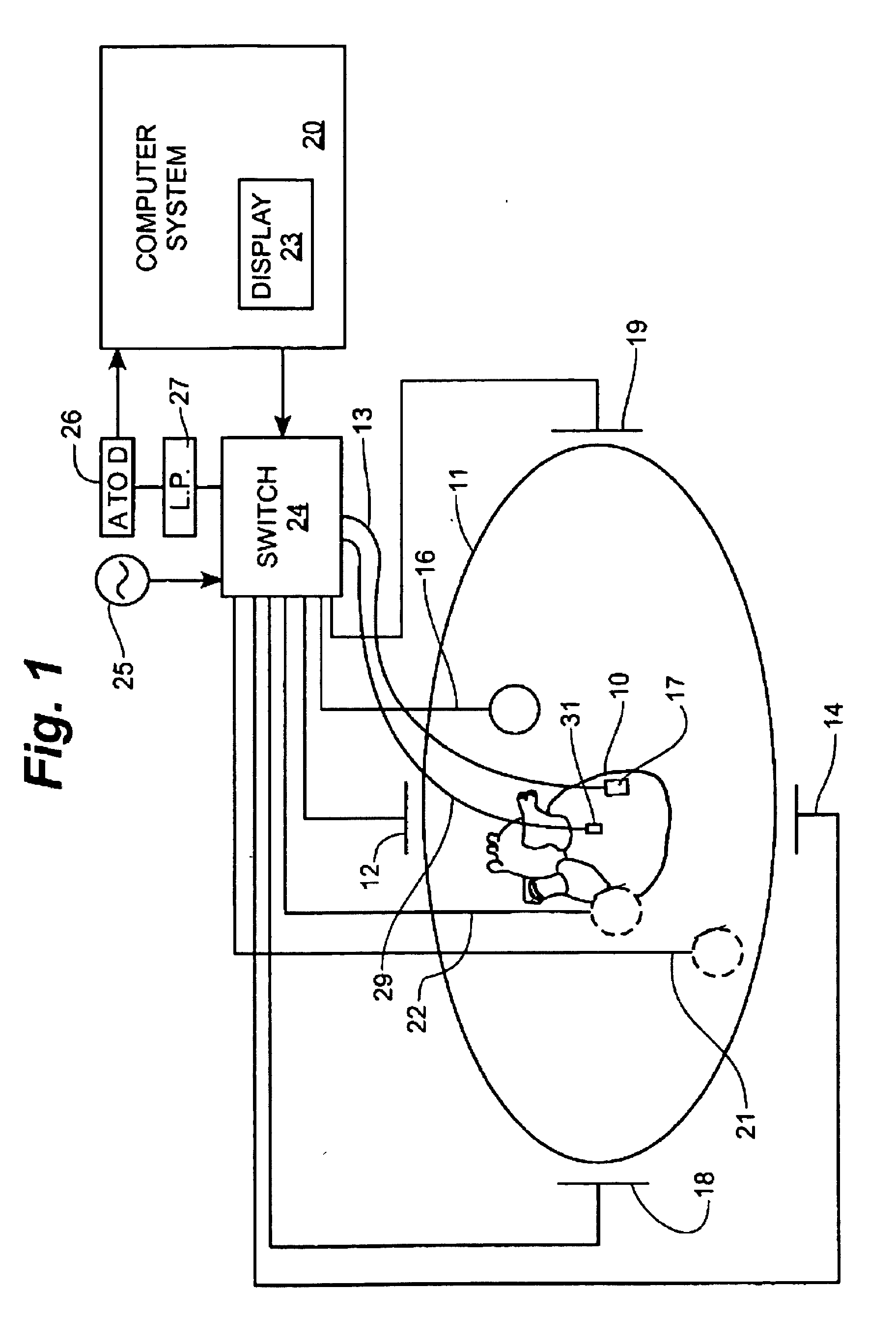 Method of scaling navigation signals to account for impedance drift in tissue