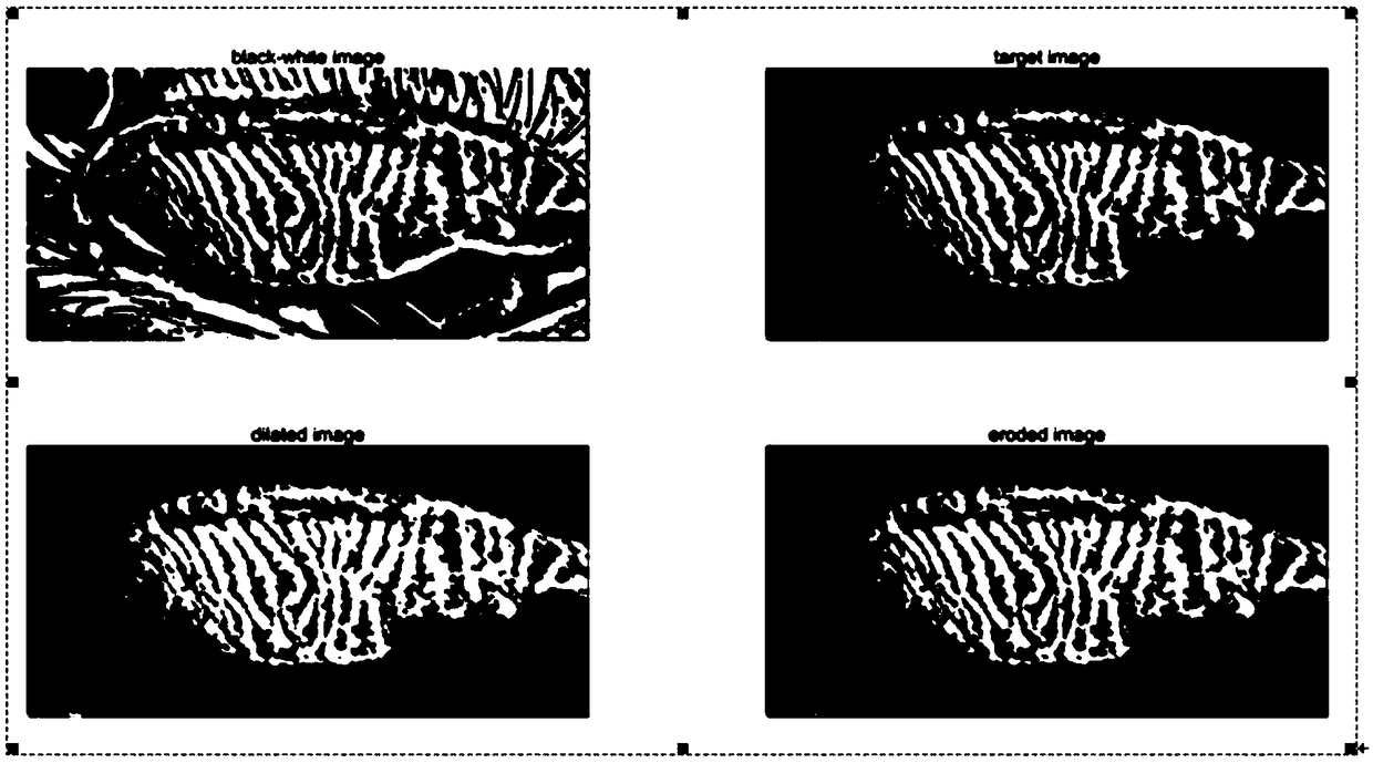 A method for quantitatively analyzing the shape and area of meibomian gland with MATLAB