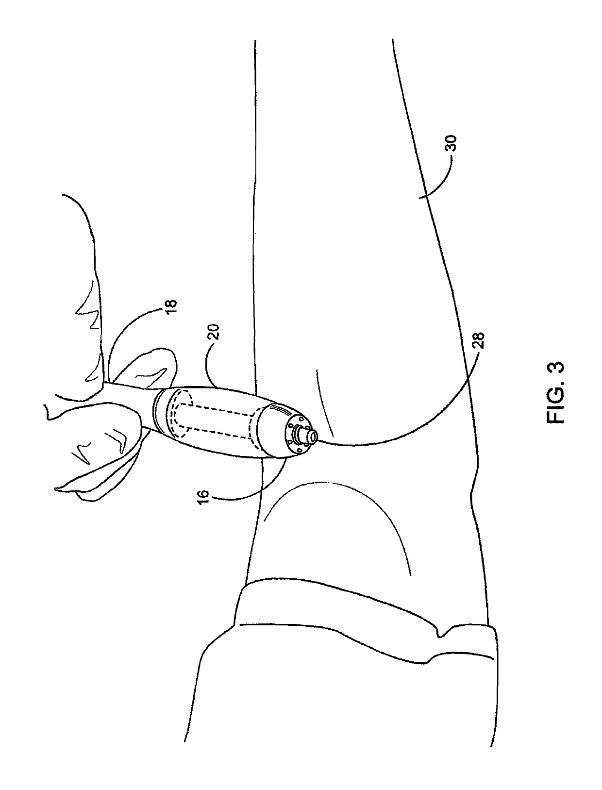 Alcohol prep applicator