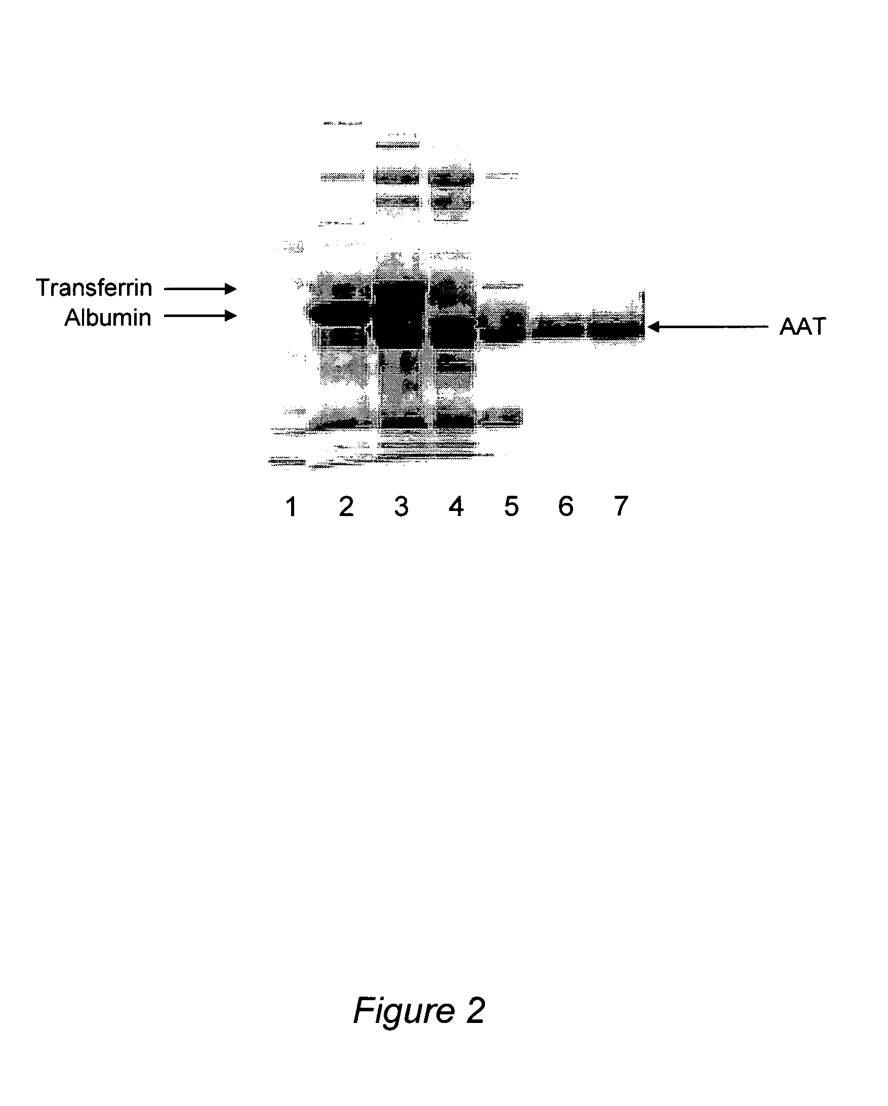 Method for purification of alpha-1-antitrypsin