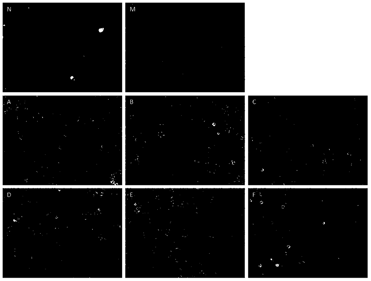 Compound preparation of active ingredients of traditional Chinese medicine for treating non-alcoholic fatty liver disease and its use