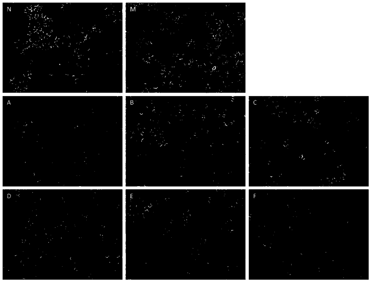 Compound preparation of active ingredients of traditional Chinese medicine for treating non-alcoholic fatty liver disease and its use