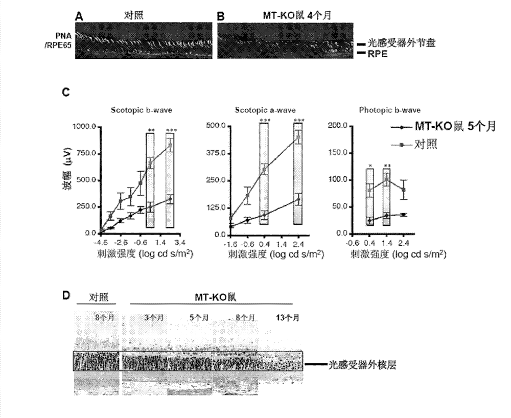 Rapamycin microemulsion injection for eyes and preparation method and application thereof