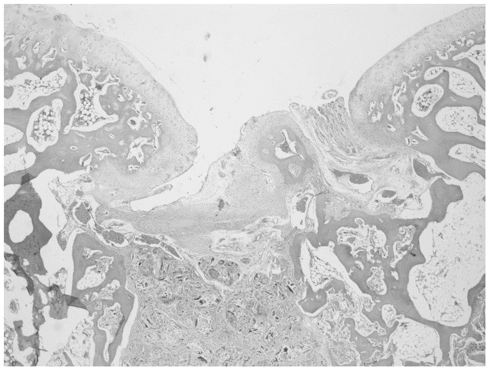 A porous scaffold for cartilage tissue engineering and its preparation method