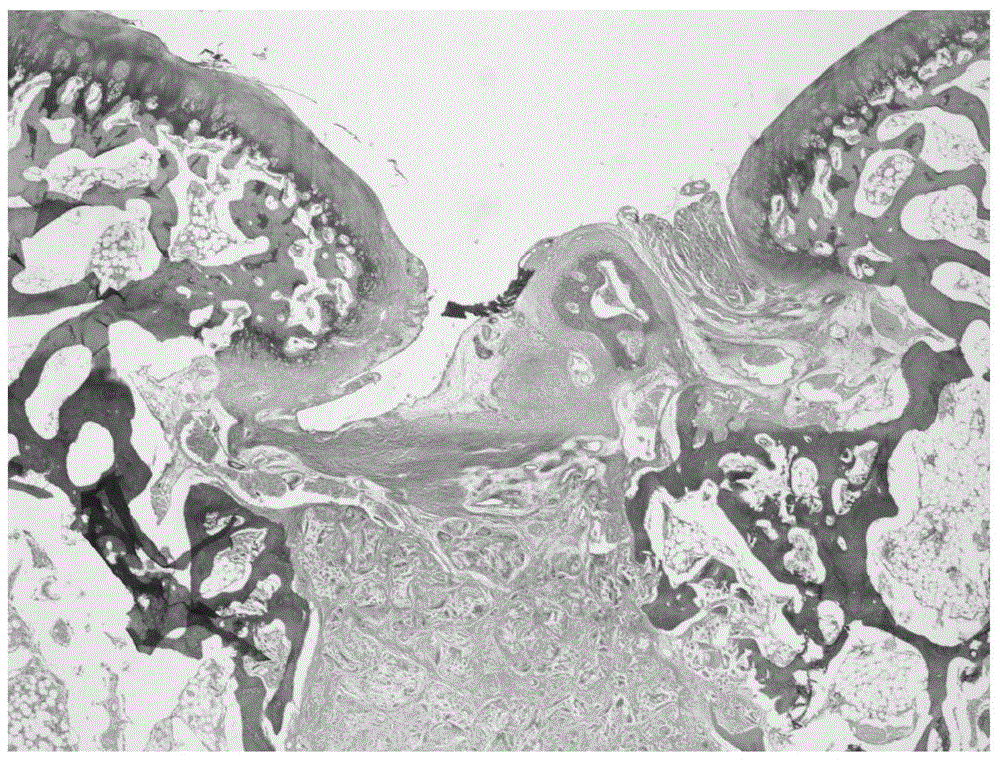 A porous scaffold for cartilage tissue engineering and its preparation method