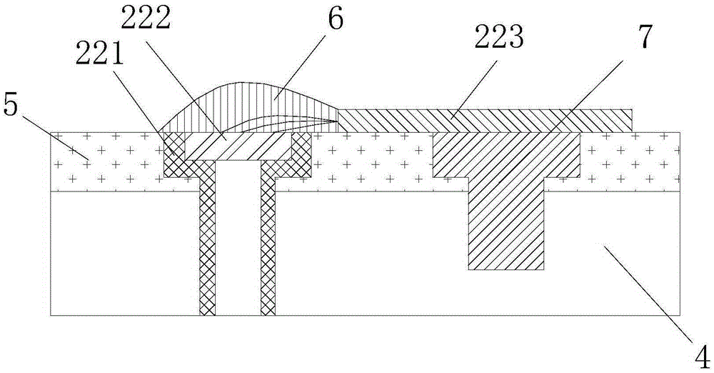 Intracranial pressure detecting system and implantation method of intracranial pressure detecting device