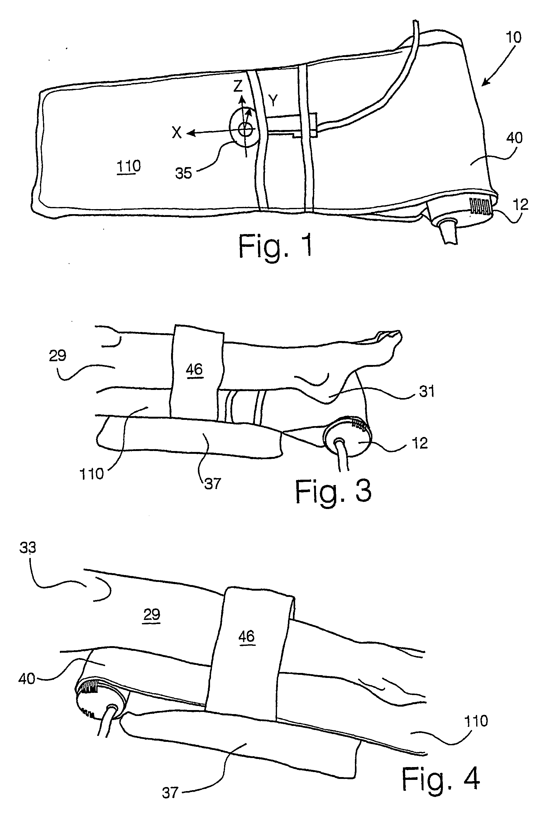 Leg ulcer, lymphoedema and DVT vibratory treatment and device