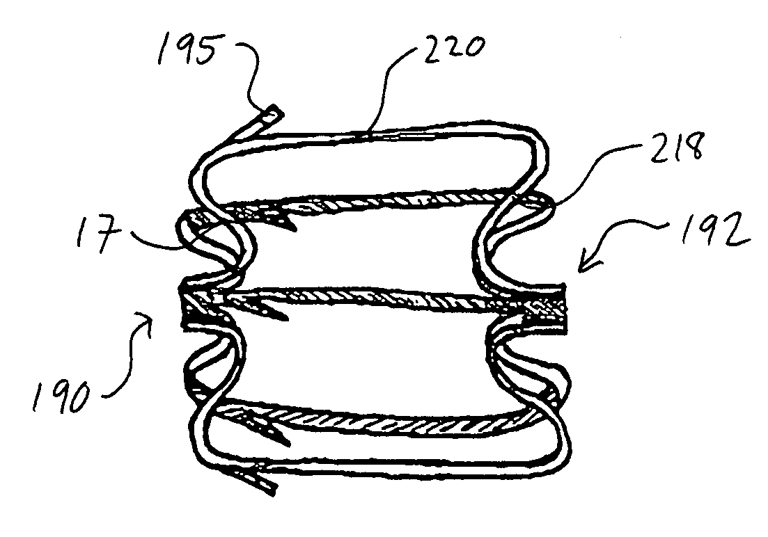 Device for containing embolic material in the LAA having a plurality of tissue retention structures