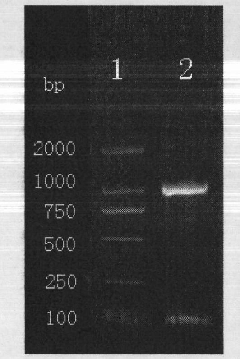 Recombinant BCG vaccine for tuberculosis prevention