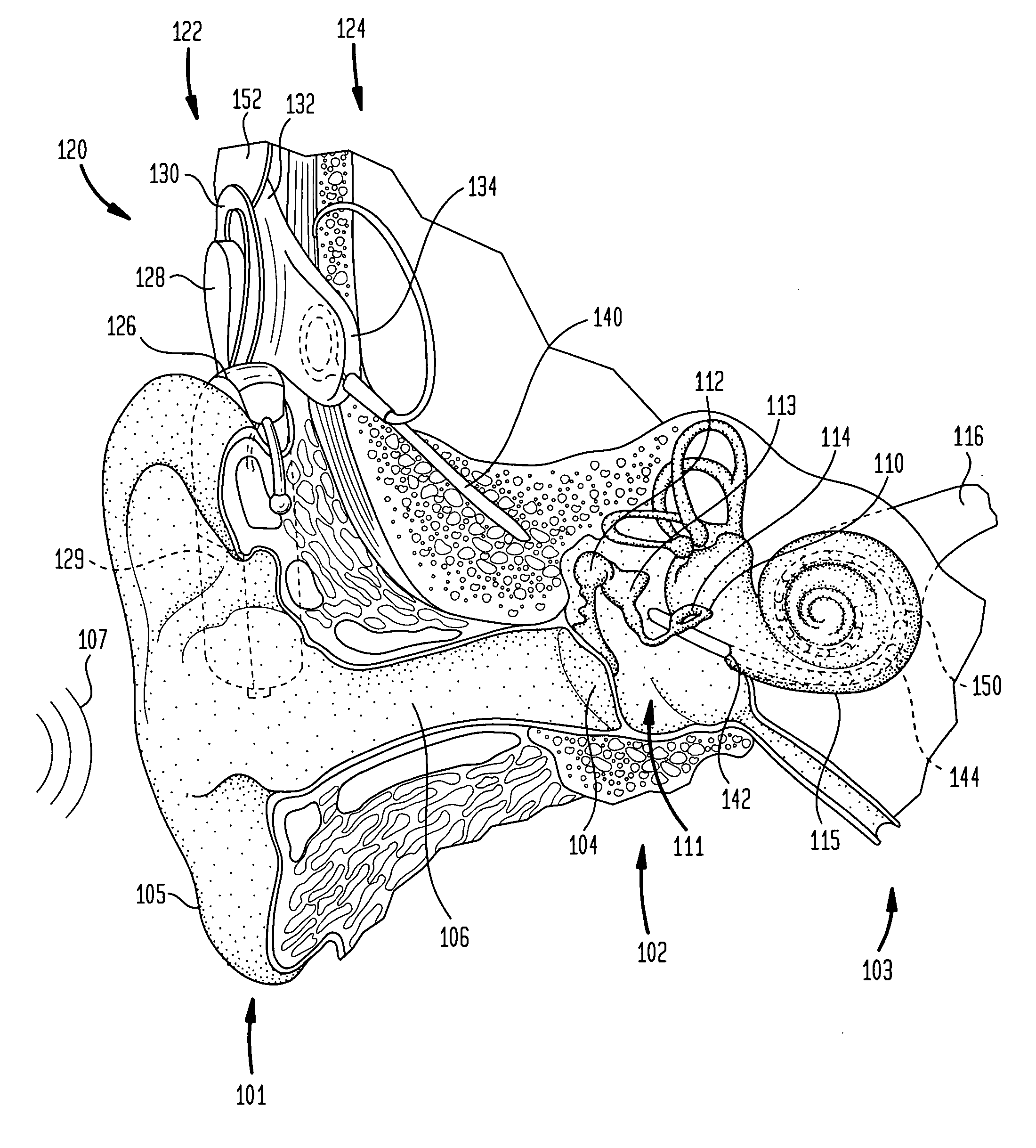 Directional sound processing in a cochlear implant