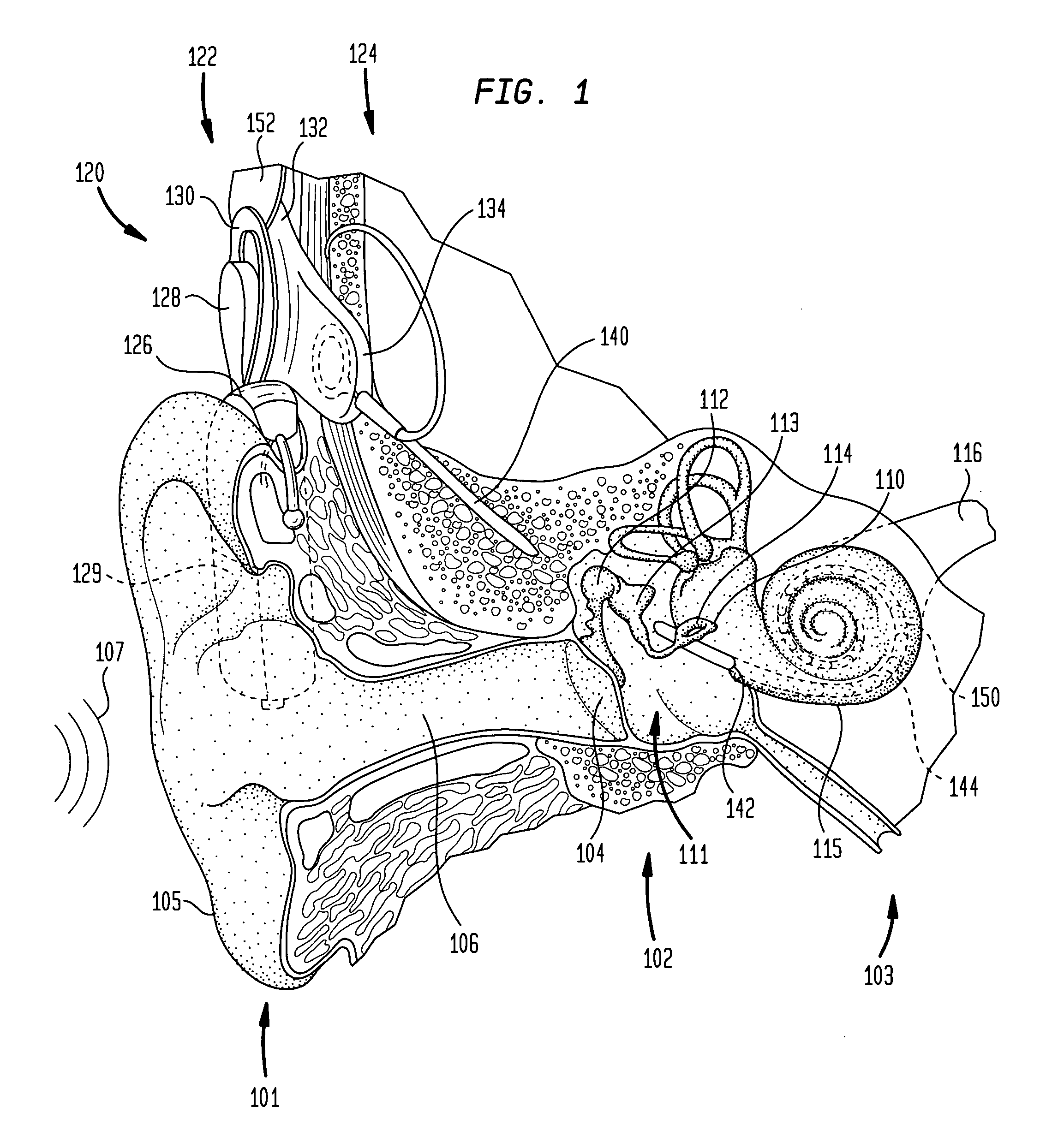 Directional sound processing in a cochlear implant