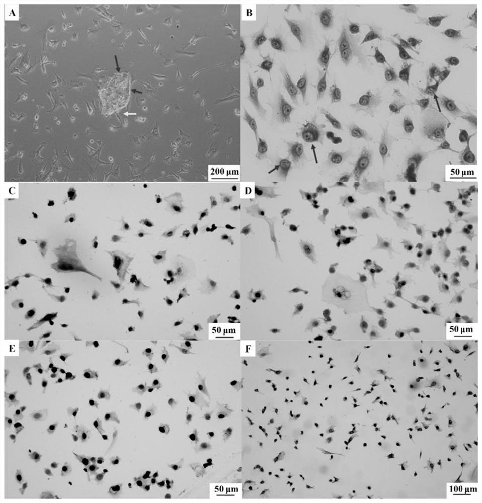 Novel pharmaceutical application of apatinib or pharmaceutically acceptable salt thereof