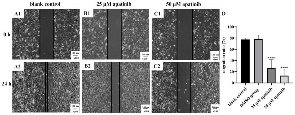 Novel pharmaceutical application of apatinib or pharmaceutically acceptable salt thereof