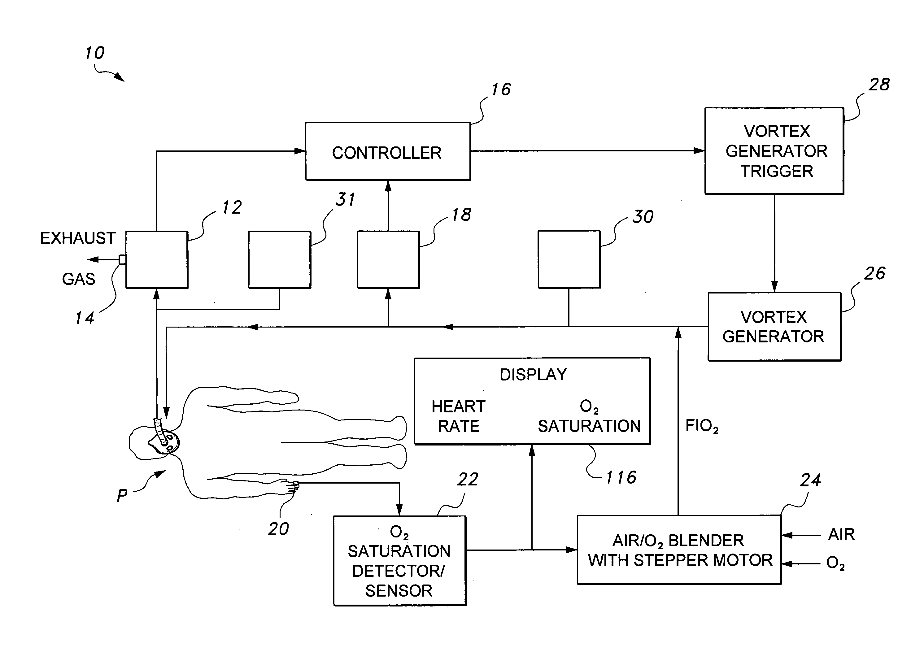 Mechanical ventilator system