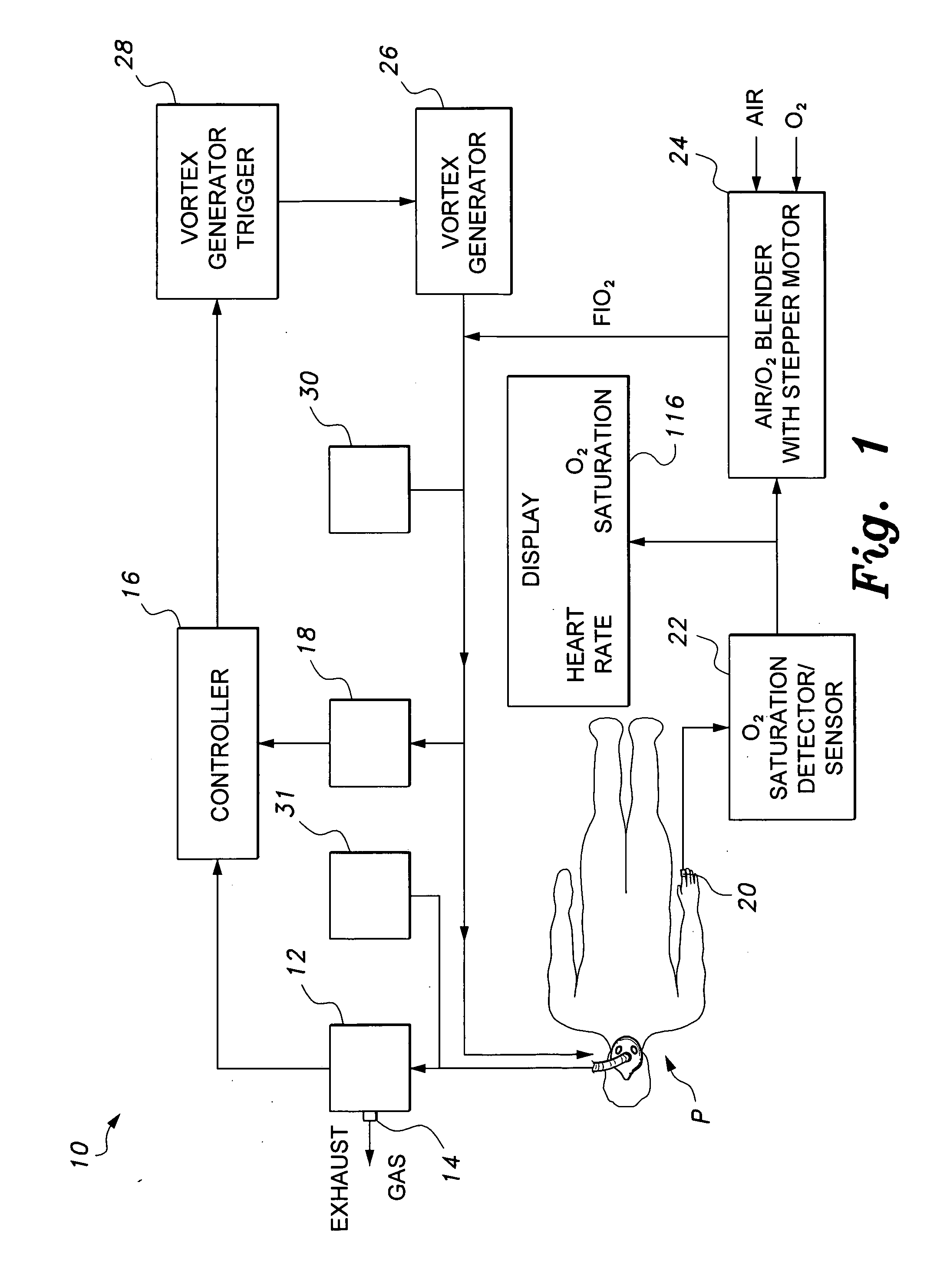 Mechanical ventilator system