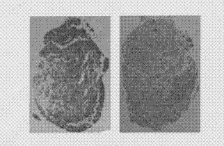 Method for differentiating induced pluripotent stem (iPS) cells into cartilage cells