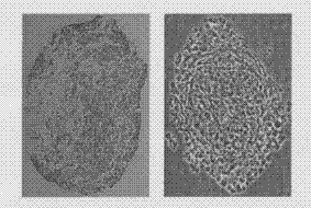 Method for differentiating induced pluripotent stem (iPS) cells into cartilage cells