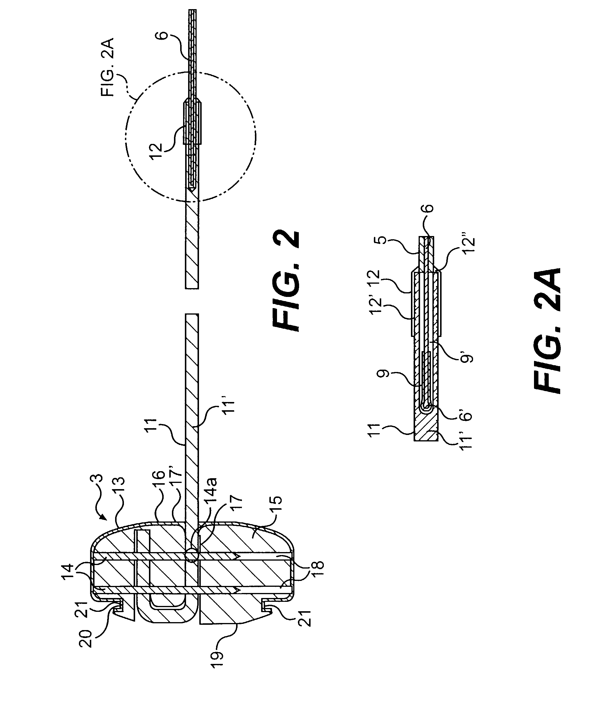 Splint assembly for improving cardiac function in hearts, and method for implanting the splint assembly