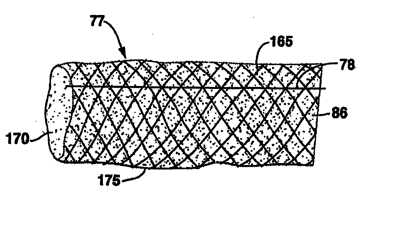 Compliant venous graft