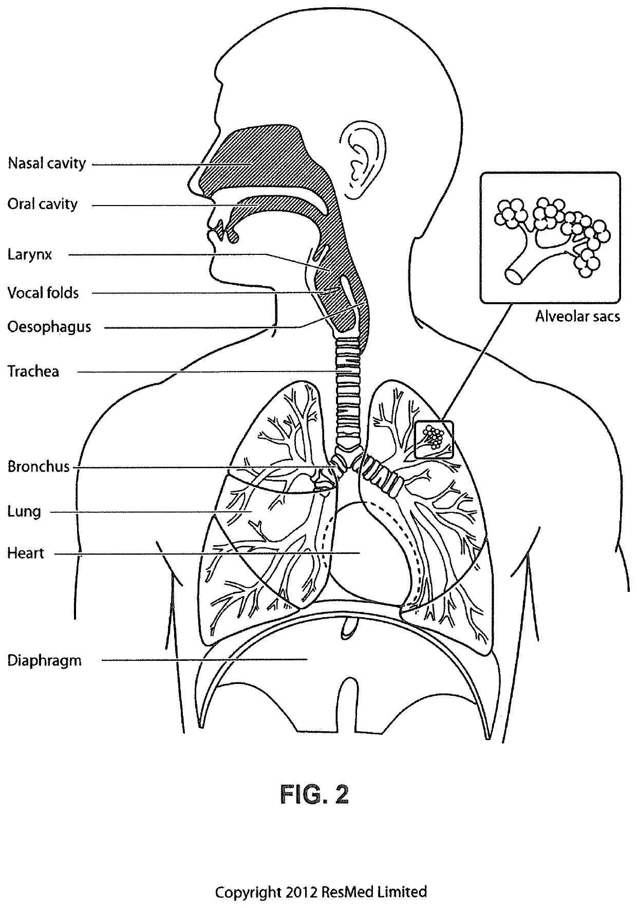 Methods and apparatus for detection of disordered breathing