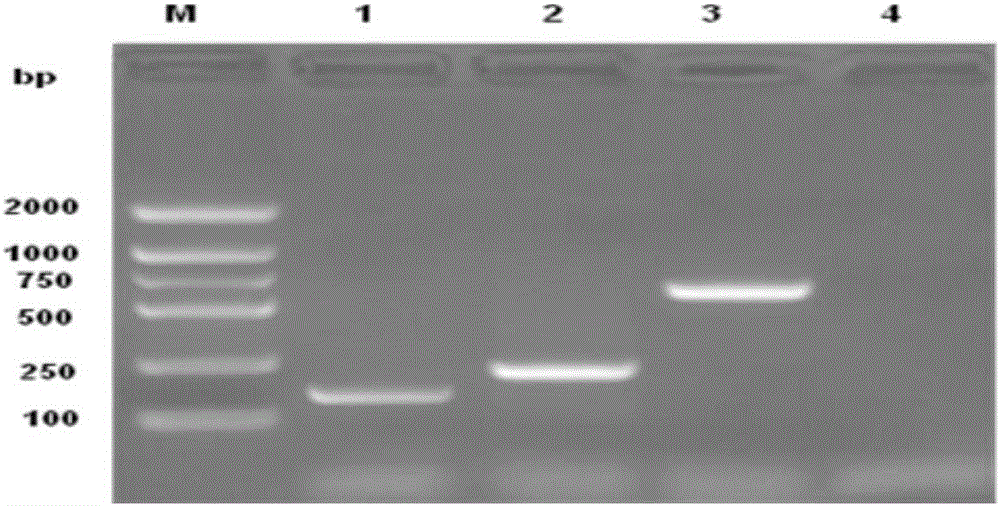 Triplex PCR detection kit for Escherichia coli serotypes O26, O45 and O121 and primer set thereof