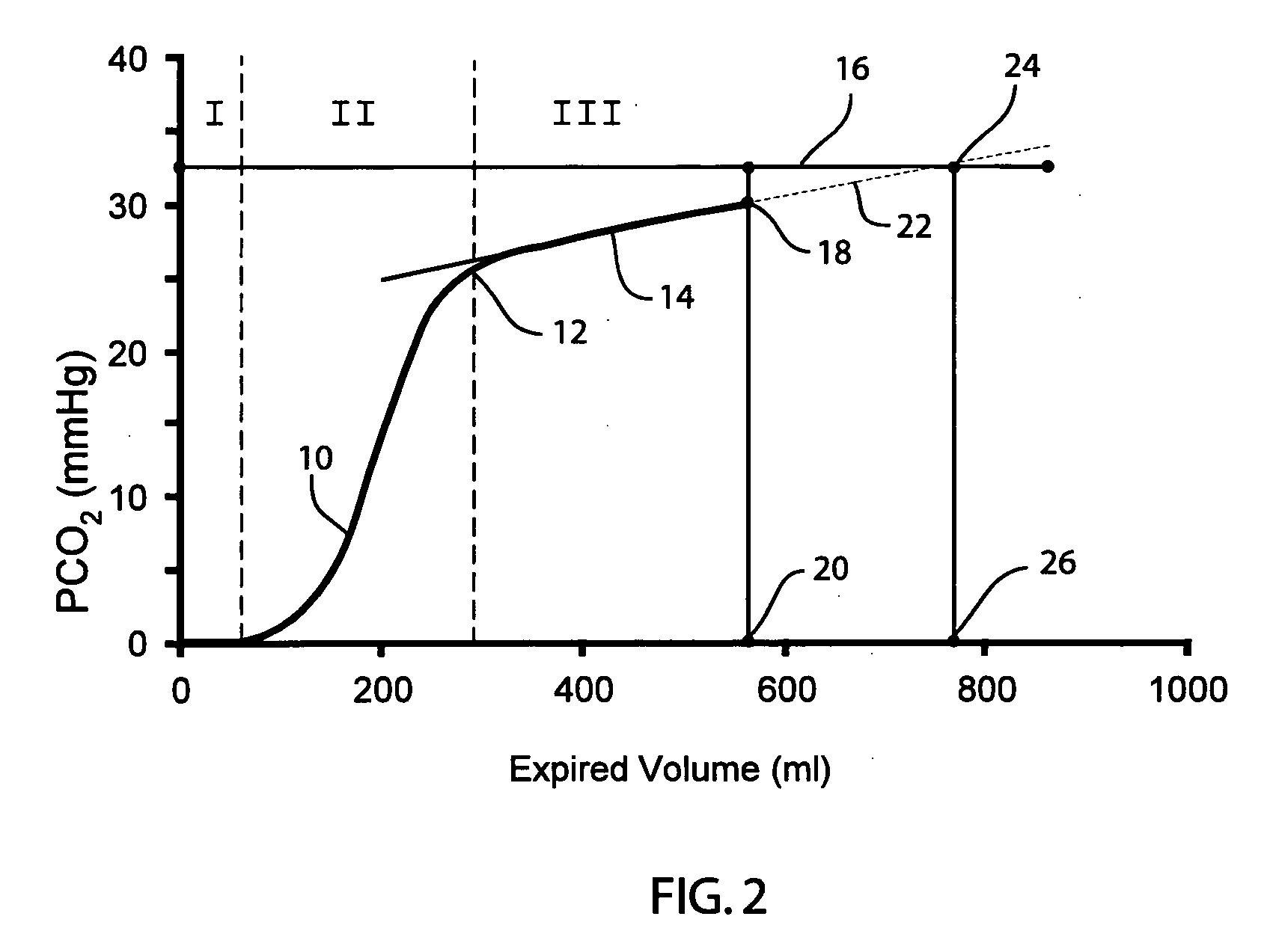 Method and apparatus for indicating the absence of a pulmonary embolism in a patient