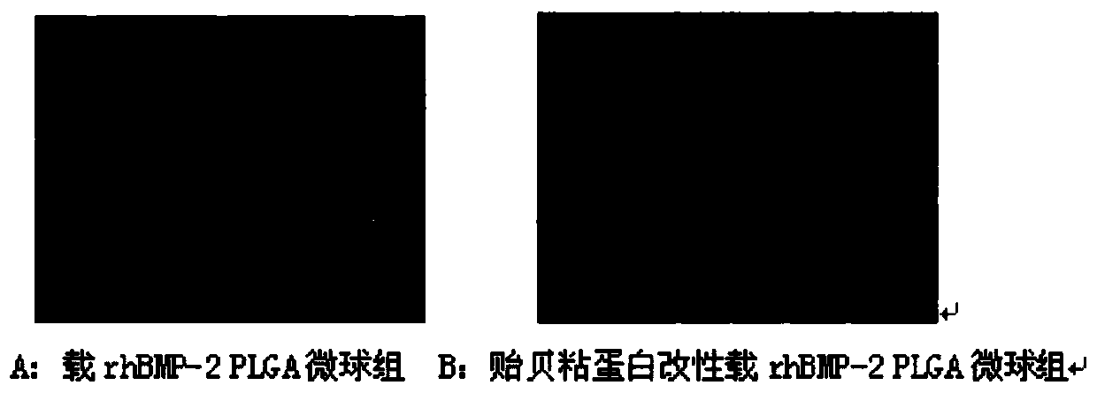 rhBMP-2-loaded bone repair material microsphere and preparation method thereof