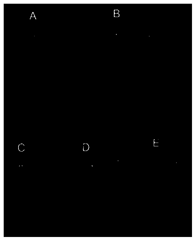 rhBMP-2-loaded bone repair material microsphere and preparation method thereof