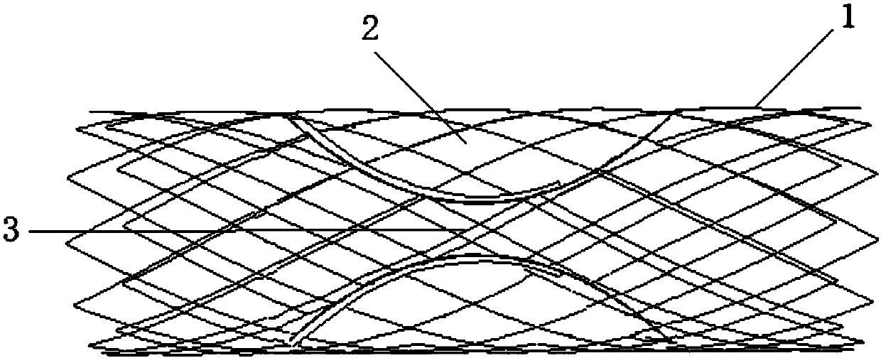 a blood flow diverter