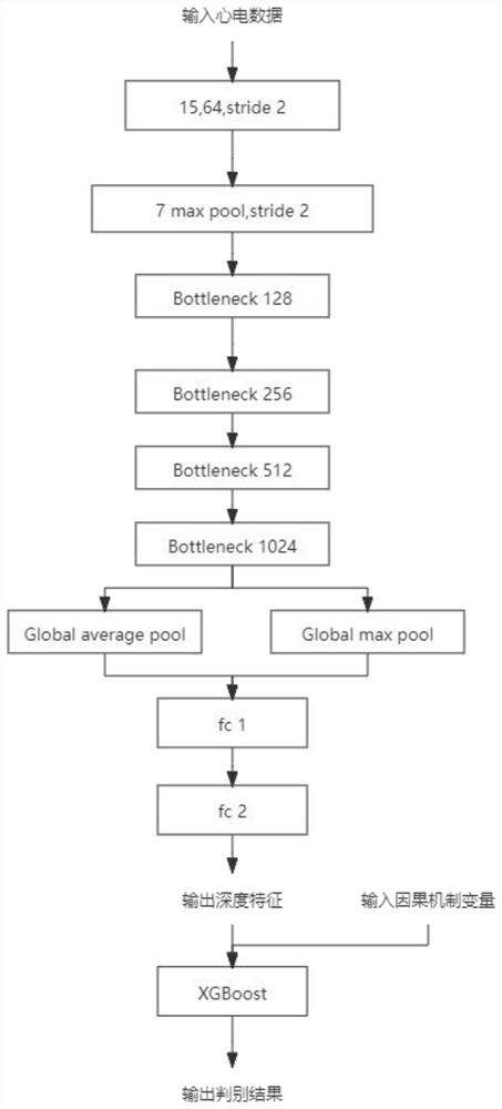 Electrocardiogram ST segment abnormity discrimination system based on causal analysis