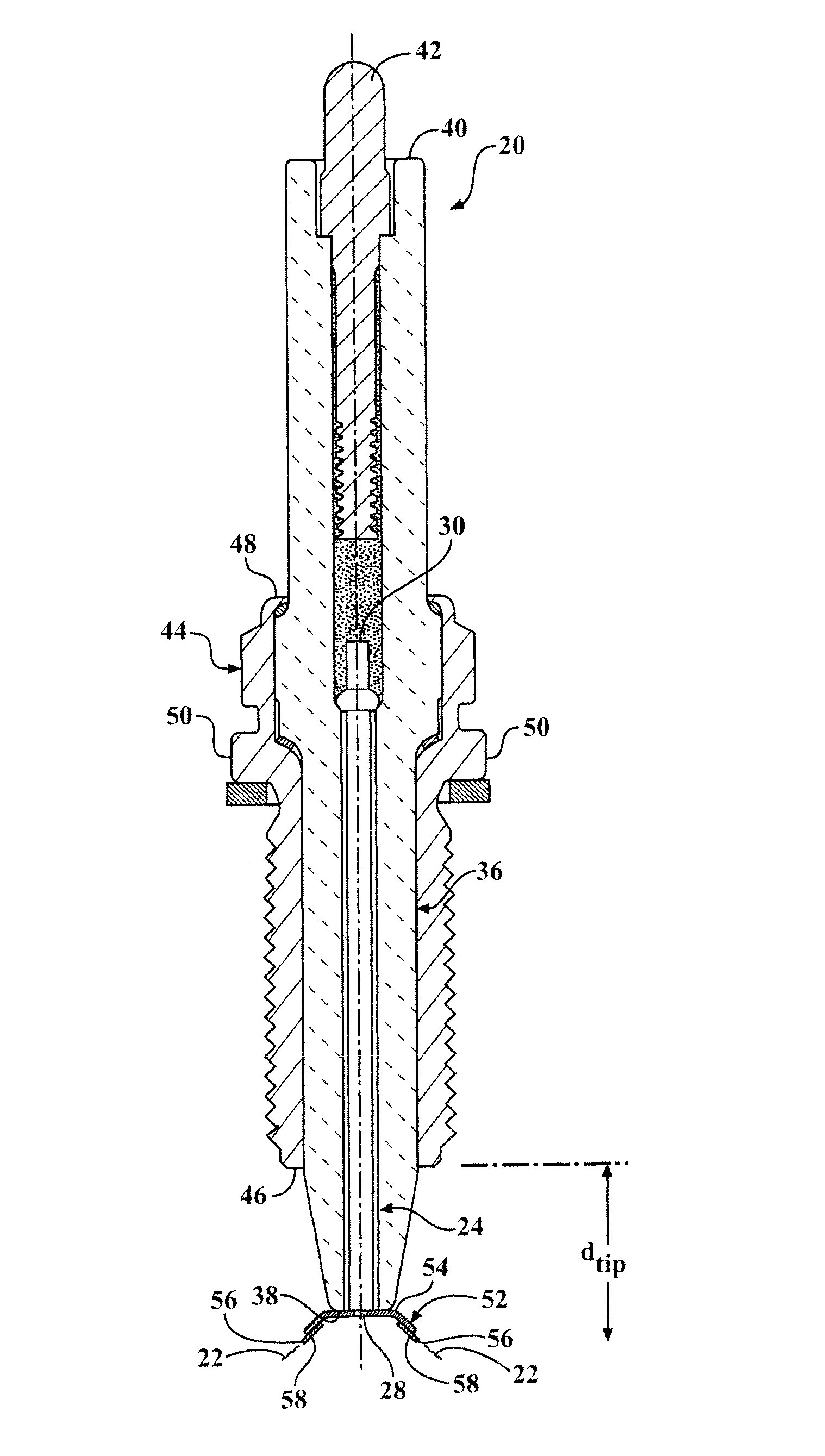 Igniter including a corona enhancing electrode tip