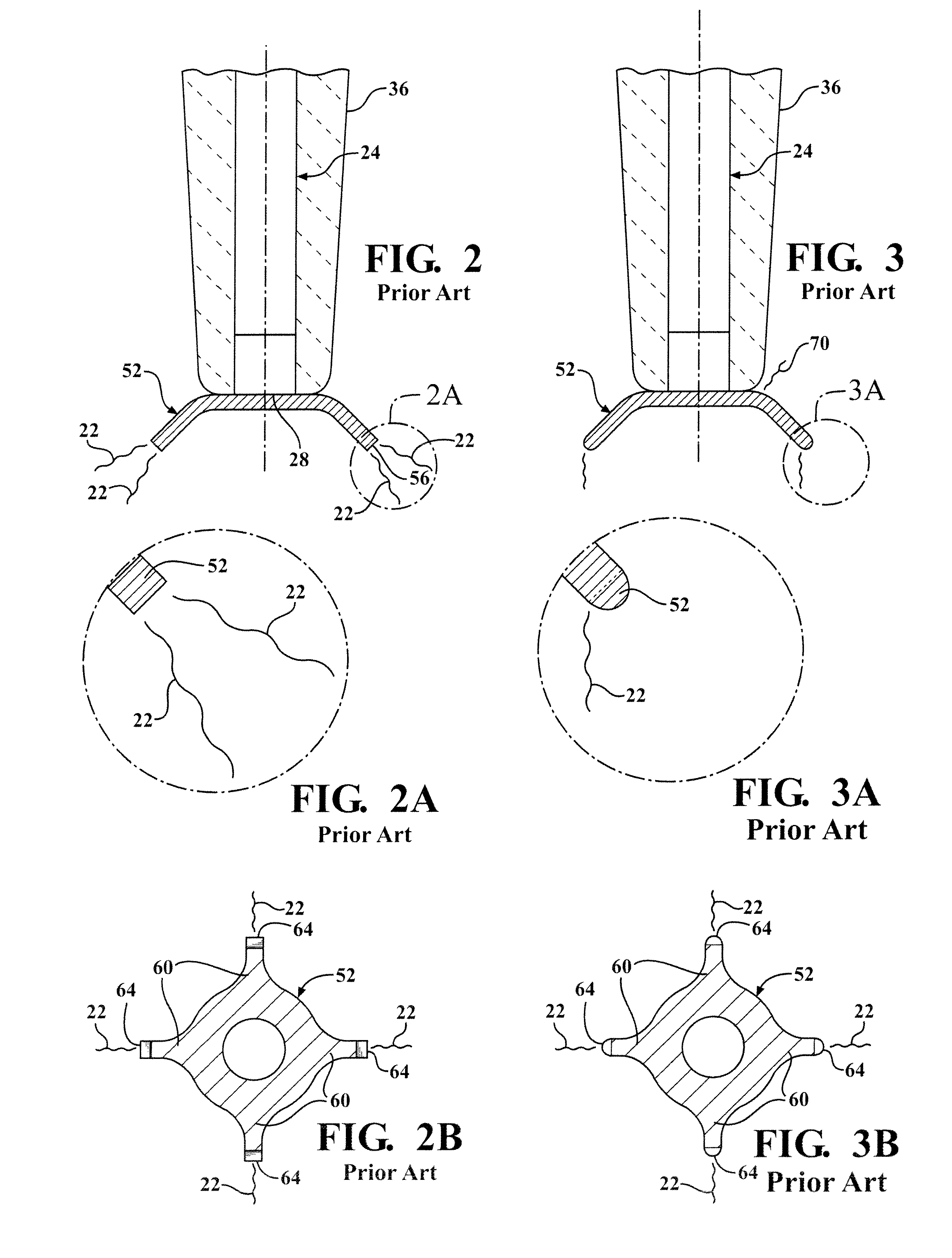 Igniter including a corona enhancing electrode tip