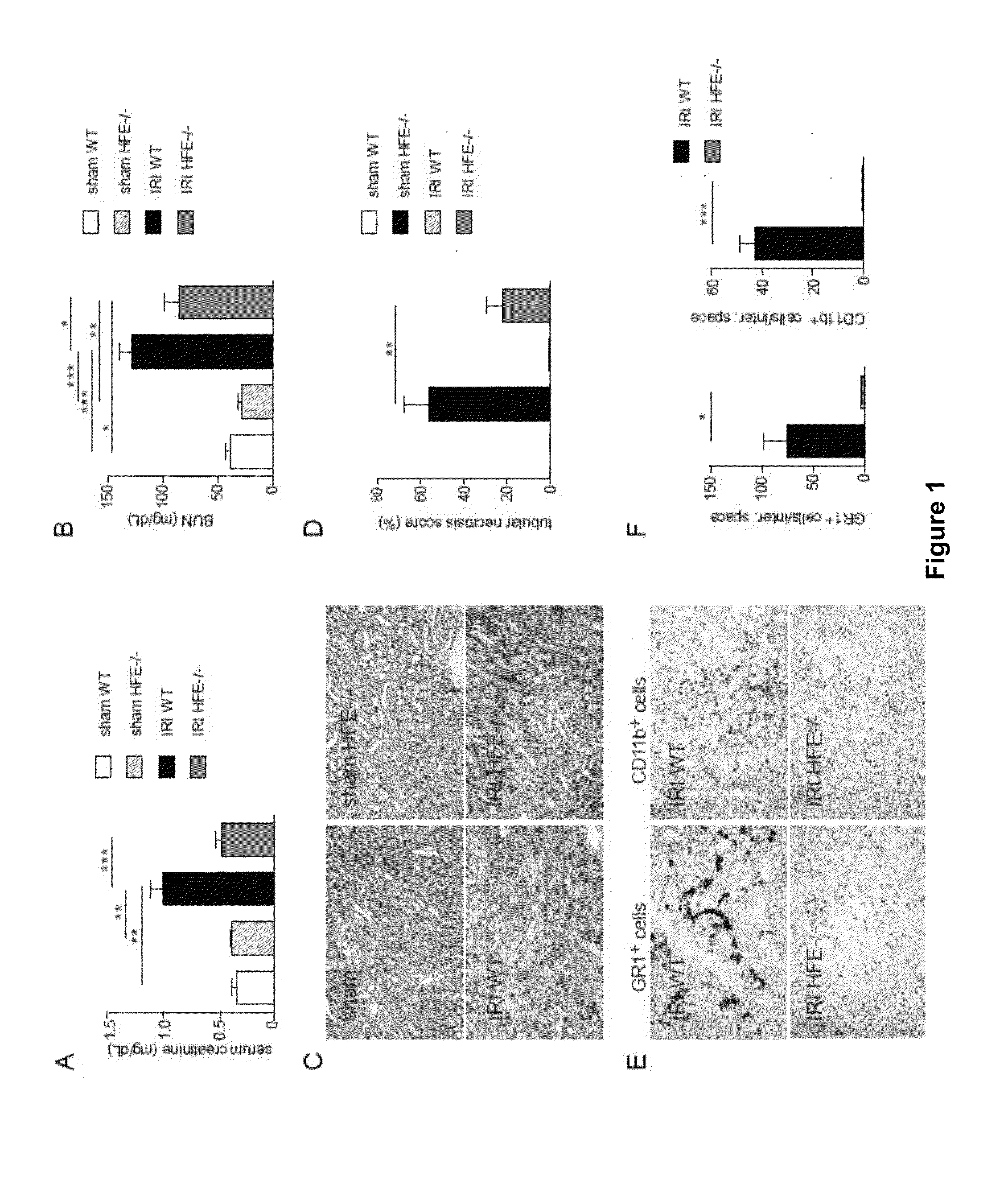 Method for Renal Transplantation