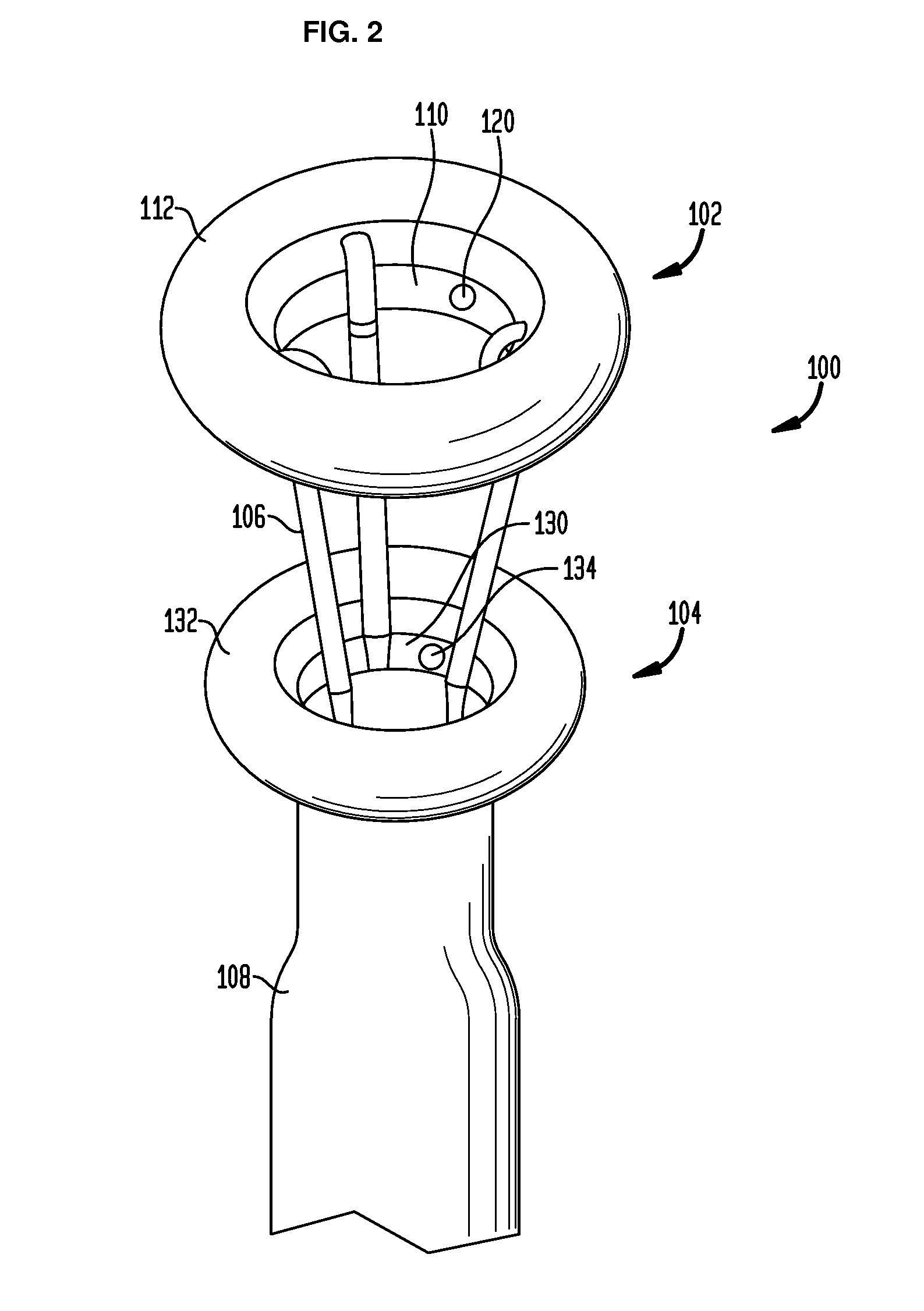 Systems and methods for treating obesity and type 2 diabetes