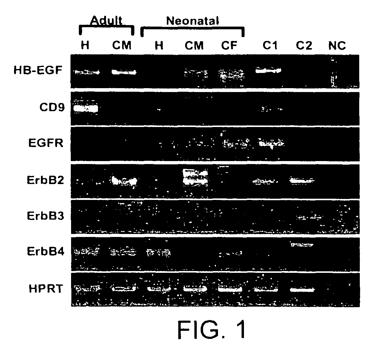 Drug for preventing or treating heart diseases comprising CD9 gene