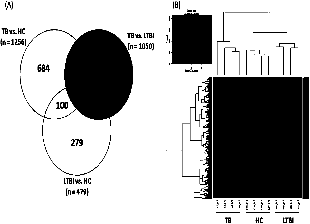 Application of RETN and KLK1 serving as tuberculosis detecting markers