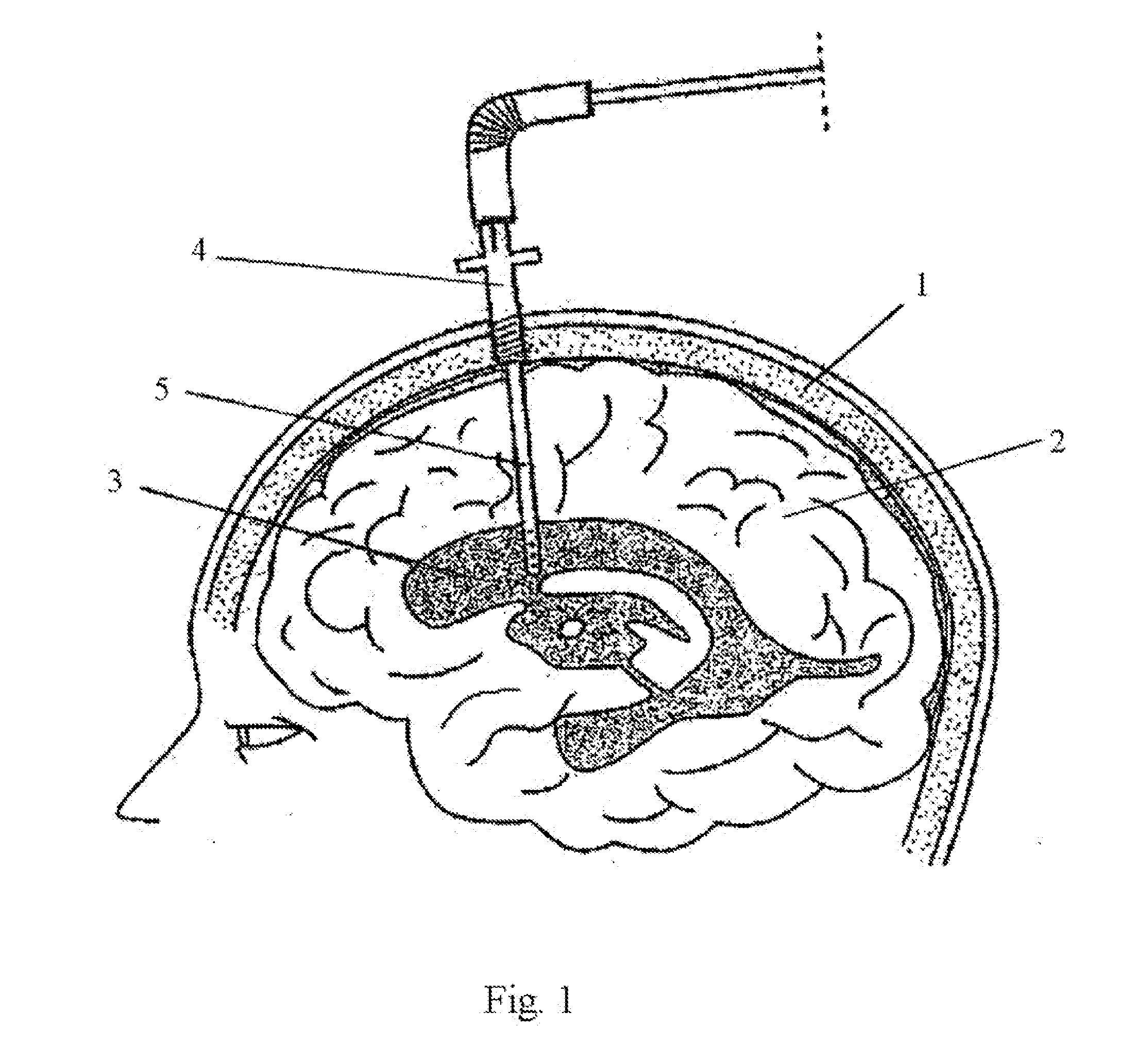 Central Nervous System Drain